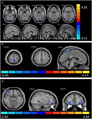 Aberrant Effective Connectivity of the Right Anterior Insula in Primary Insomnia